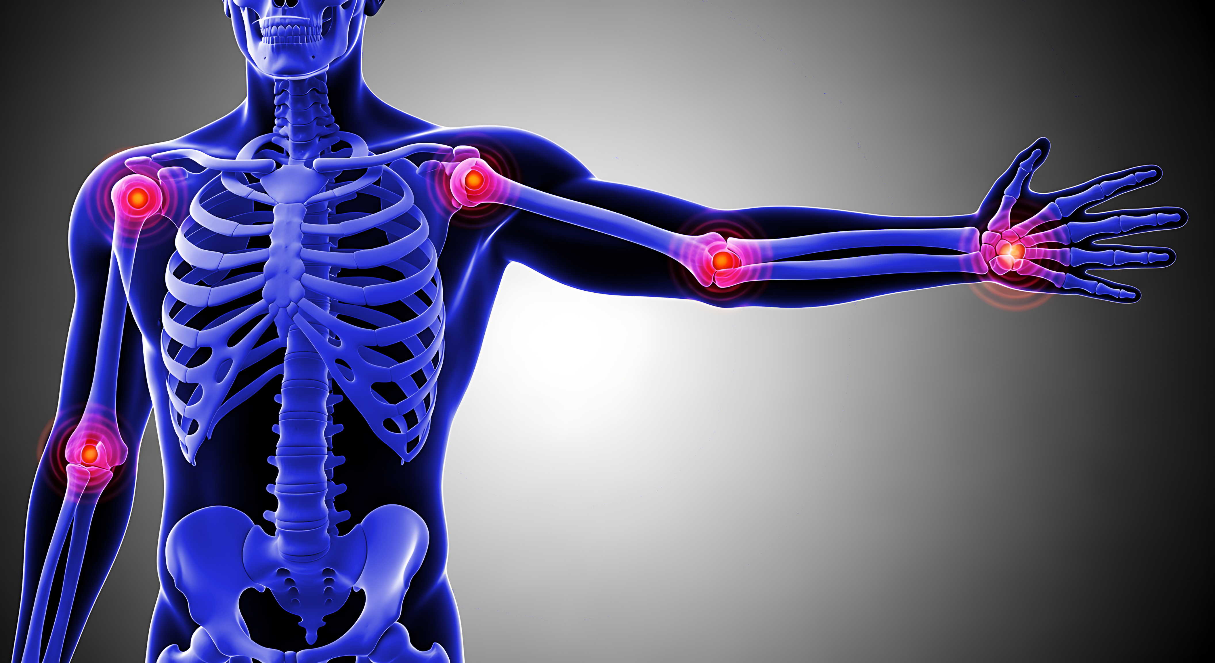 Image de squelette avec articulations en rouge